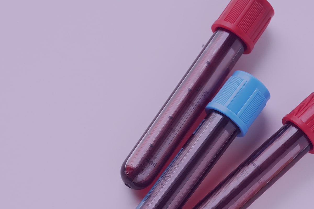 Entenda a metodologia aplicada no Teste de Anticorpos Coronavírus (IgG e IgM) do Labi