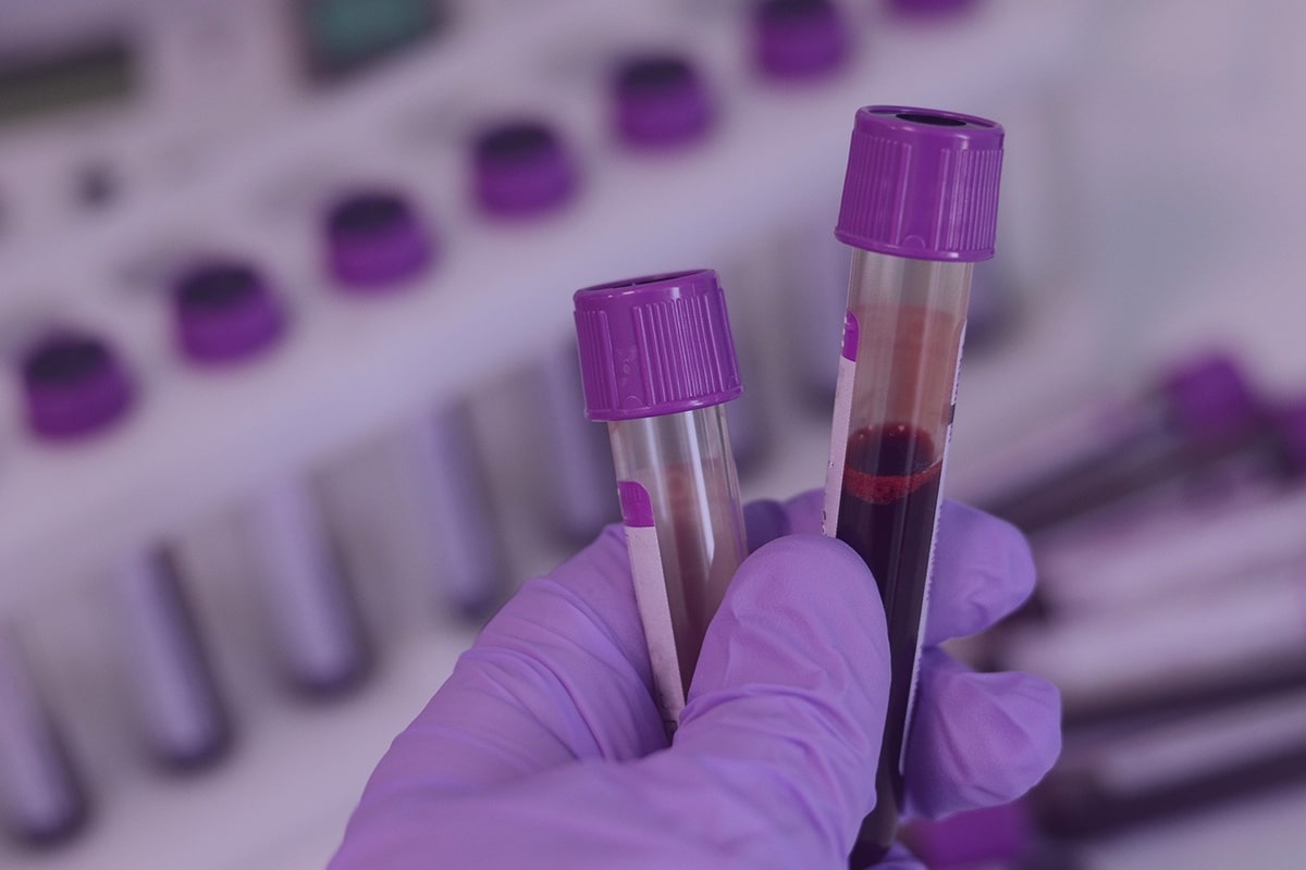 Hemograma completo: quais doenças são detectadas?