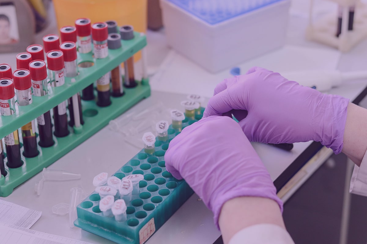 Exame de sangue: saiba tudo sobre o preparo desse exame