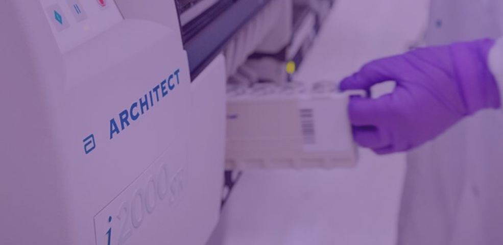 Labi Exames lança novo Teste de Anticorpos Coronavírus (IgG) considerado o mais preciso do mundo