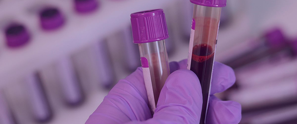 Profissional analisando amostra de sangue