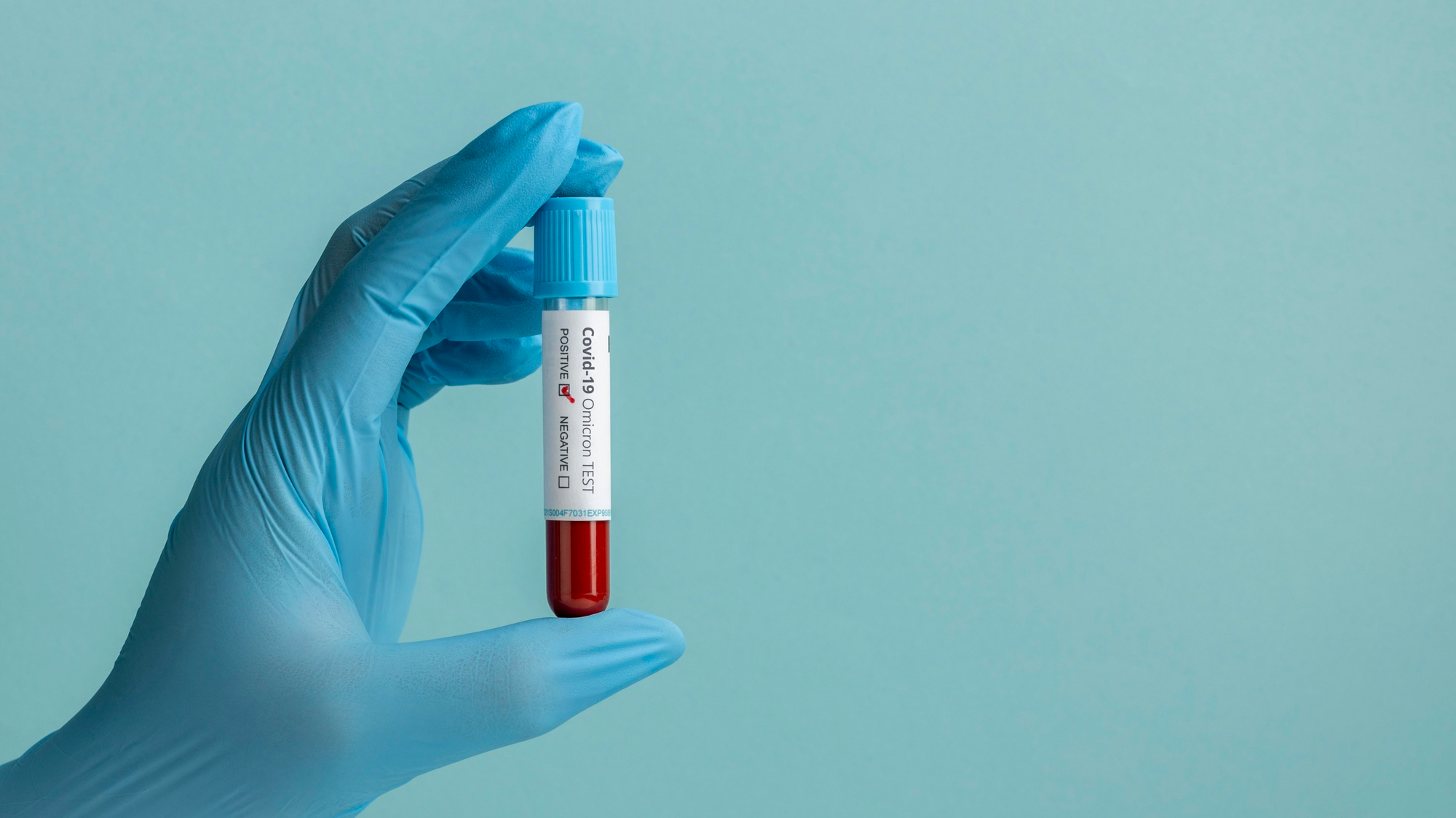 Tireoide: o que é e para que serve o TSH